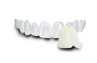 Full mouth veneers in smile makeover mexico